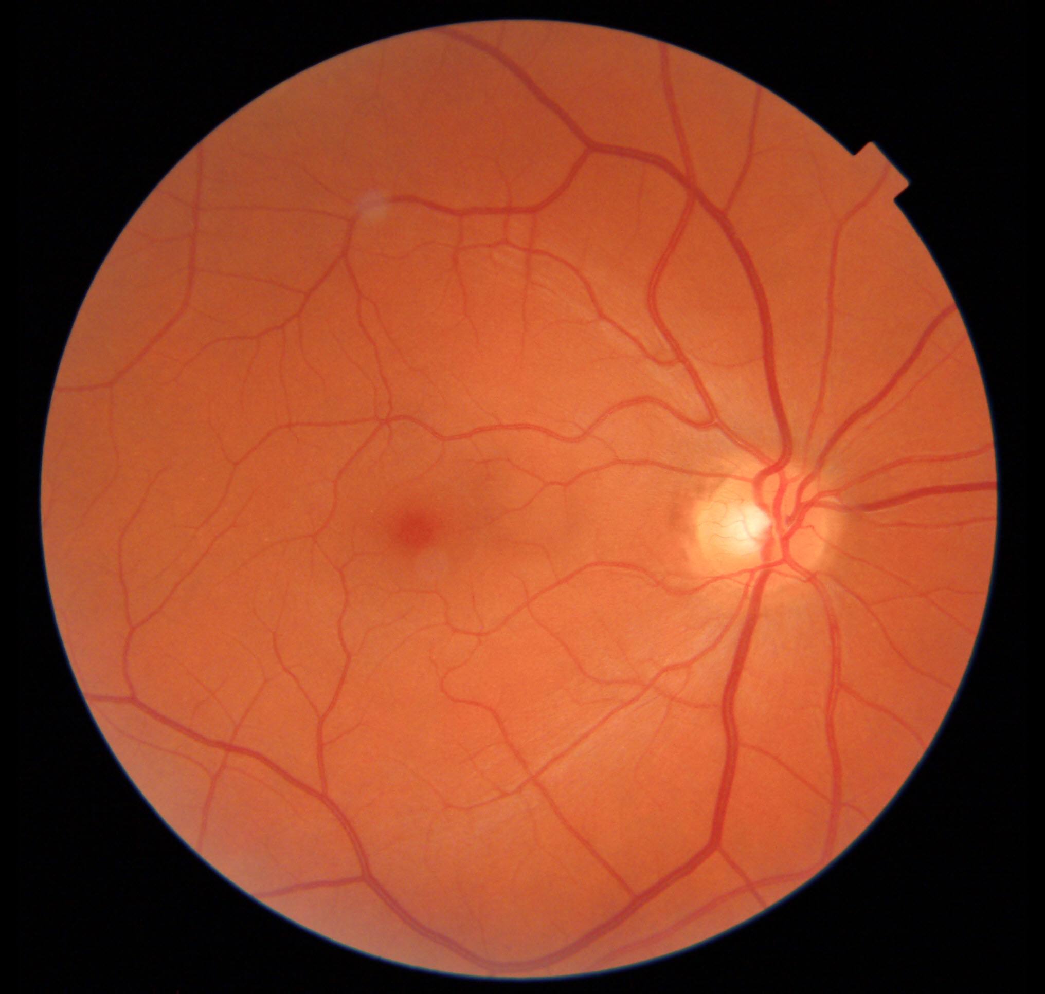 The Eyedeal Experience